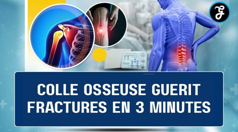 Colle osseuse guérit fractures